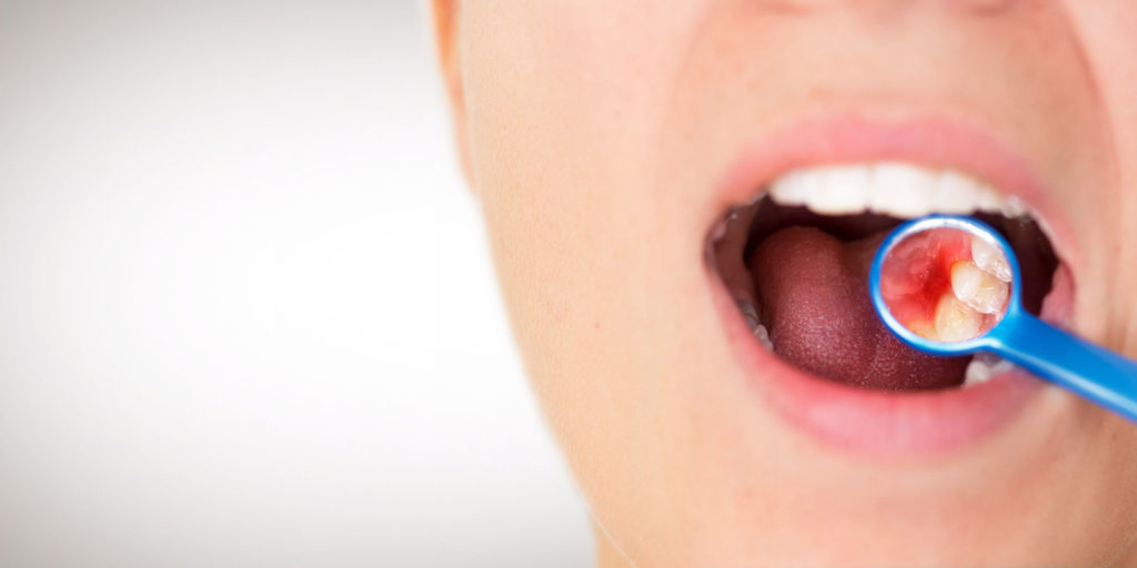 dental patient with gum disease